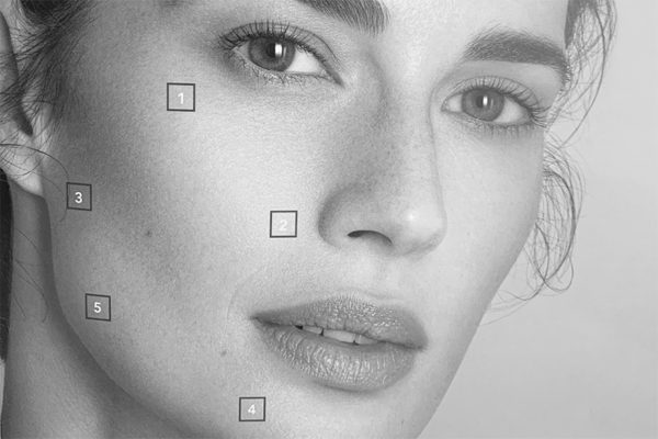 biostimolazione bioristrutturazione medicina estetica parmeggiano