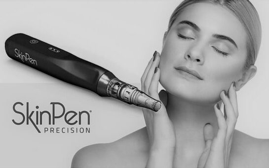 skinpen trattamento estetico bologna