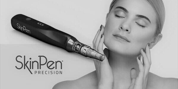 skinpen trattamento estetico bologna