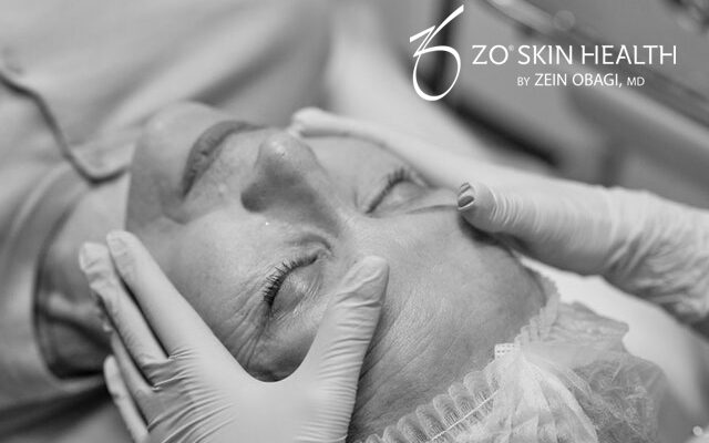ZO skin health federica parmeggiano